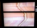 The Fourth Kind - Dr Abbey Tyler Hypnosis session