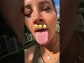 Does She Have Tongue Cancer