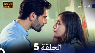 حب أعمى الحلقة 5 Arabic Dubbed 