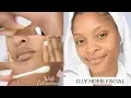 HOW TO DO A FACIAL AT HOME Includes Extractions KRYSSTOBER 8
