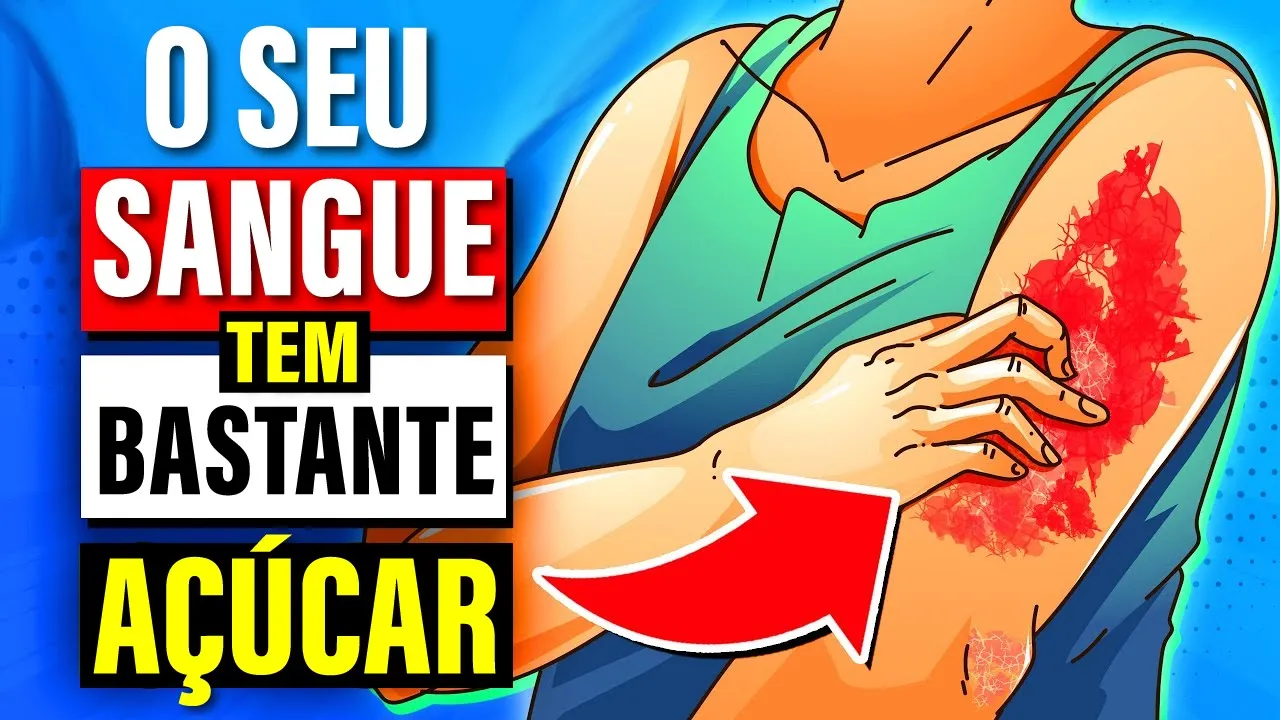 9 Sinais de que seu AÇÚCAR no SANGUE está ALTO
