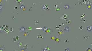 JHOC-5 GFP Chemotaxis Migration