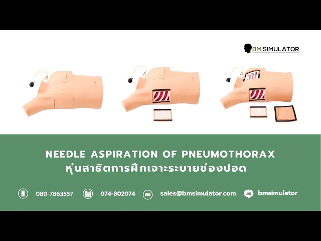 S078 หุ่นฝึกการเจาะระบายช่องปอด  Needle Aspiration of Pneumothorax
