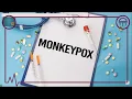Monkeypox Virus - Explained