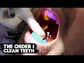 The Order I Clean My Patient s Teeth My Scaling Sequence