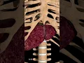 Download Lagu Can You Survive with Liver Cirrhosis