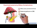 Management of Postcholecystectomy Biliary Complications