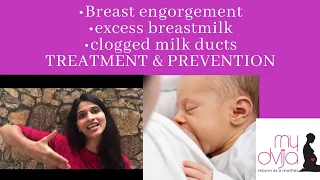 Download Breast Engorgement | Excess breastmilk | Clogged Milk Ducts | treatment \u0026 prevention MP3