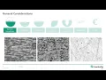 Post Processing of L-PBF-M Parts
