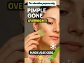 Download Lagu Aloe Vera Ice Cube Hack 🌿❄ Shrink Pimples Overnight | Clear Skin Fast!\