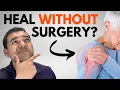 Can a Shoulder Labrum Tear ACTUALLY Heal Naturally Without Surgery