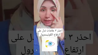 احذر ٣ علامات تدل على ارتفاع الكوليسترول Cholesterol Gene وراثى ارتفاع الكوليستيرول 