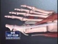 Virtually Pain Free Bunion Surgery By Expert Dr Moy
