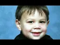 Mystery Diagnosis - Piruvate Complex Dehidrogenase Deficiency