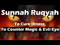 Sunnah Ruqyah | To Cure Illness, And Counter Magic \u0026 Evil Eye | Powerful Ruqyah