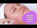 Vacuum Cupping Therapy Facial Facial Massage Lymphatic Drainage Massage Part 2 myChway 2183