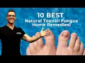 #1 BEST Toenail Fungus Treatment? [Top 10 Home Remedies] 2024