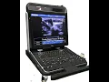 Download Lagu Mobile colour doppler ultrasound with best price Ebit 60
