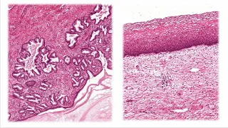Sistema Reprodutor Feminino - Histologia