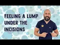 Feeling A Lump Under The Incisions Gastric Sleeve Surgery Questions Answers