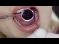 Cosmetic Dentistry in Reading PA details at YellowPages com