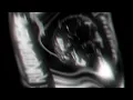 RUKIDDINGME-Sweepz & TRA$HCVNDY