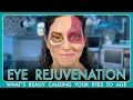 Why Your Eyes Look Tired And What Actually Fixes It