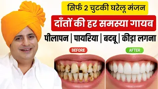 दाँतों का पीलापन, पायरिया और कीड़ा लगने का उपाय || Homemade Tooth Powder || Sanyasi Ayurveda ||