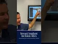 Breast Implant Scars Where Do The Incisions Go