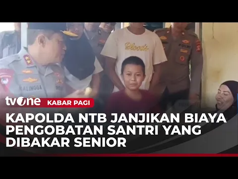Kasus 3 Santri Dibakar Senior, Polisi Segera Rilis Tersangka