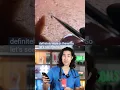 Ingrown Hair vs Tweezers Doctor Reacts