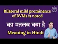 Bilateral mild prominence of BVMs is noted meaning in Hindi Spoken English