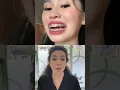 Shocking Truth About Dentists Changing Your Bite with Orthodontics