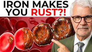 The Truth About Iron Deficiency: What Your Doctor Isn't Telling You