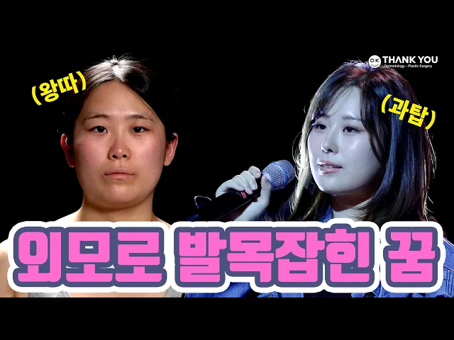 외모때문에 발목잡힌 내 꿈ㅣMAKE ME Girl(맥미걸)ㅣ내이름은캔디ㅣ땡큐성형외과