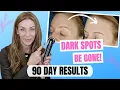 Download Lagu Surprising Results for Hyperpigmentation!| JOVS Blacken Photorejuvenation Device|Dark Spot Treatment