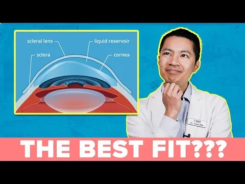 A MUST WATCH: How to Get the Best Scleral Lens Fit!!!!!