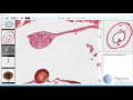 vMicro A Brief Look at Virtual Microscopy