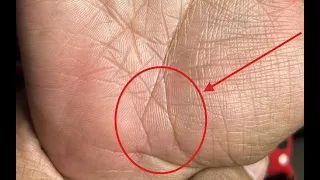हाथ पर अति भाग्यशाली मछली का चिन्ह, ऐसा चिन्ह आपको बना सकता है करोड़पति - संपर्क करें +917009126730