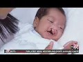 Lancaster Cleft Palate Clinic