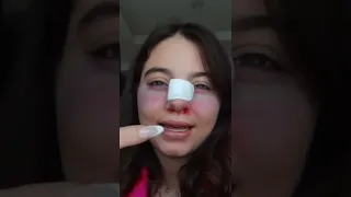 بيسان اسماعيل عملت عملية تجميل 