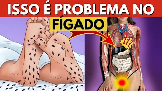 12 Sinais Chocantes que seus pés dão sobre problemas de fígado