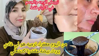 واش باقا كترميه فالقمامة؟وهو كينقي الوجه من التصبغات والكلف  والنمش اثار لحبوب يرجع كيلمع🤩معجزة 