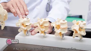 ทำไมการประคบเย็นถึงควรใช้เฉพาะในช่วงแรกของการบาดเจ็บที่คอ