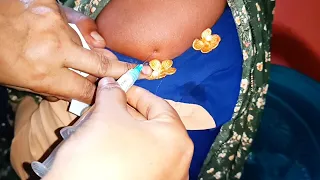 How to Give Arm IM Injection (Soma-Ject) | Family Planning Method | 26 Ep 08 Anik Health Tips