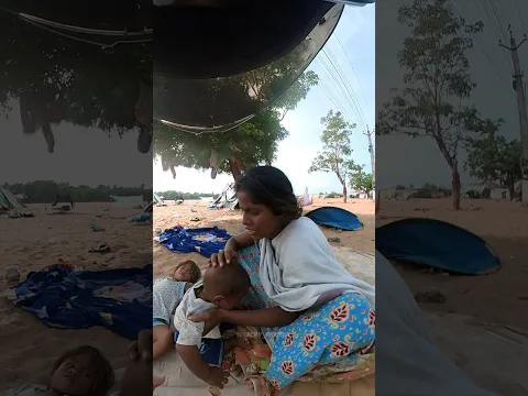 kuzhanthaikku kosu kadichchu thalaiyellaam pun aayiduchu anna 🥺