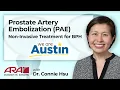 Prostate Artery Embolization - A Non-Invasive Treatment for BPH
