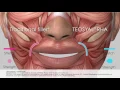 Traditional Filler VS TEOXANE RHA The Era of Dynamic Aesthetics