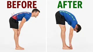 L4–L5 & L5–S1 Disc Bulges: Pain-Free and Back to Work Without Surgery