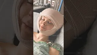 My Facial Feminization Surgery Male to Female Transgender Transition Update